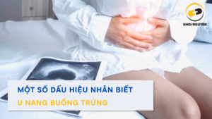 MỘT SỐ DẤU HIỆU NHẬN BIẾT U NANG BUỒNG TRỨNG